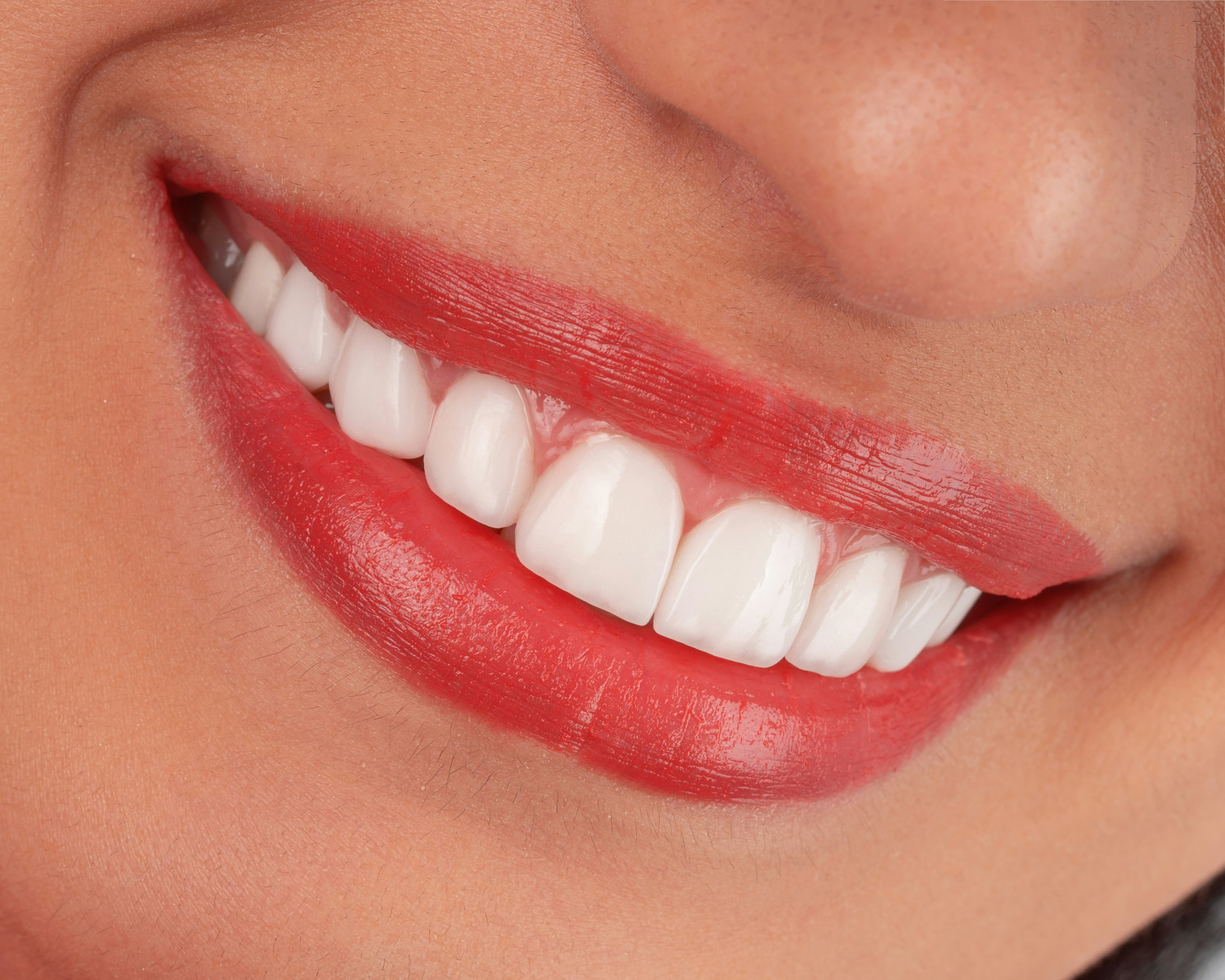 Close-up of a bright, natural white smile