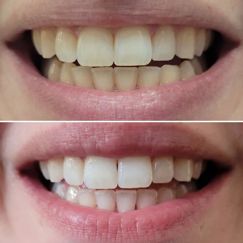 Before and after The Starter Kit