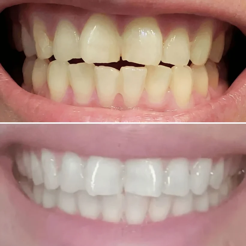 Before and after The Pro Bundle